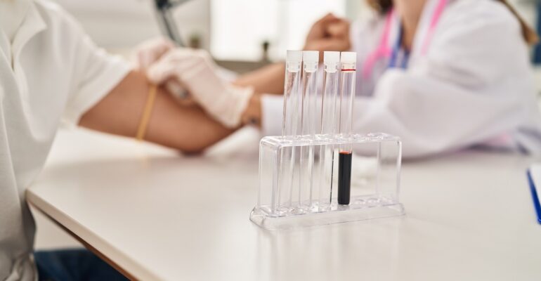 ¿Cómo prepararte antes de tus exámenes de laboratorio clínico?