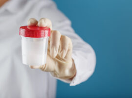 ¿Qué es un espermograma y cuándo se realiza?