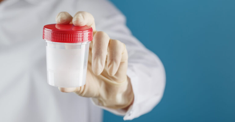 ¿Qué es un espermograma y cuándo se realiza?