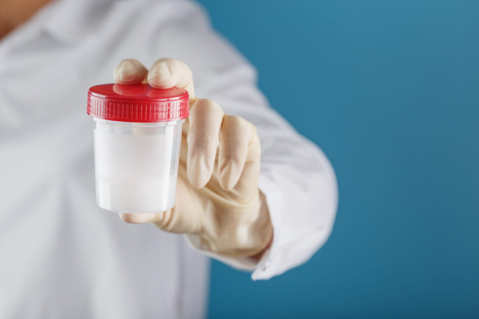 ¿Qué es un espermograma y cuándo se realiza?